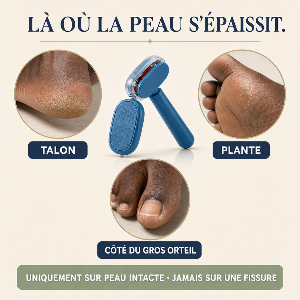 Zones de peau épaissie adaptées au Mistglide One-Pass