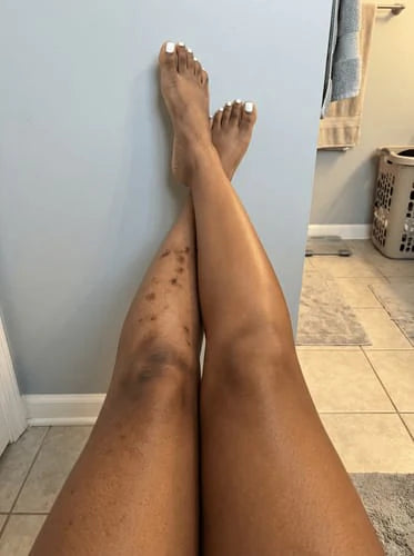 Fini naturel Body Perfect sur les jambes