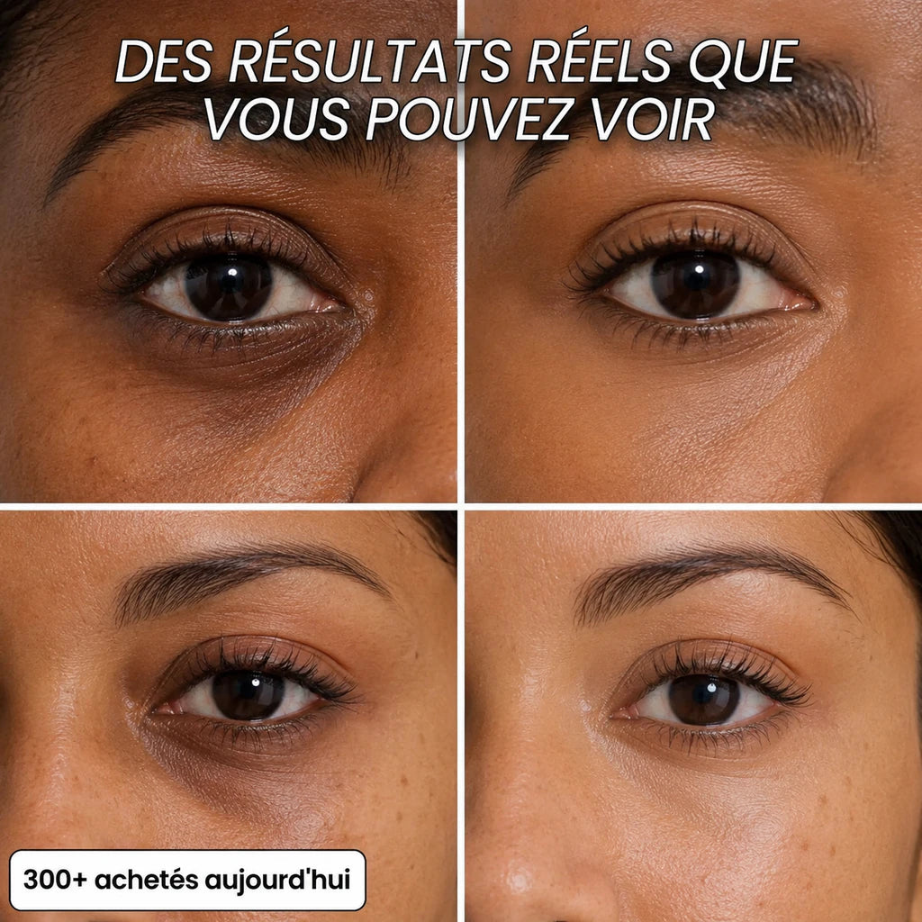 Stick Repulpant 5 % Volufiline, PDRN & Collagène