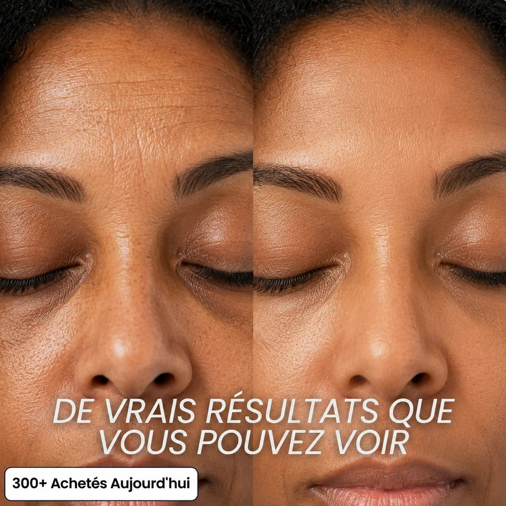 Stick Repulpant 5 % Volufiline, PDRN & Collagène