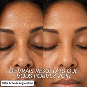 Stick Repulpant 5 % Volufiline, PDRN & Collagène