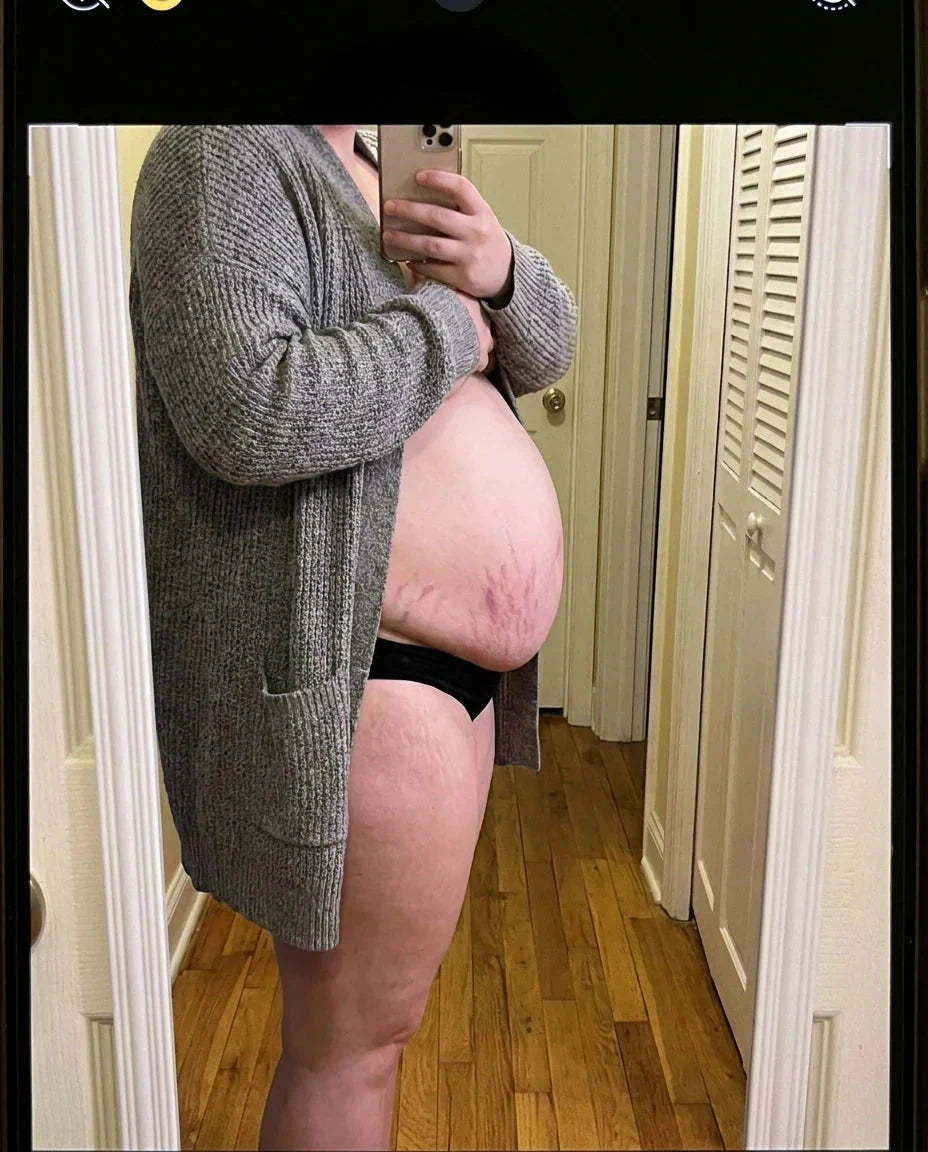 Ventre post-partum de profil à la maison